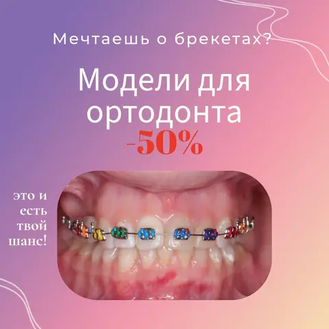 модели для ортодонта