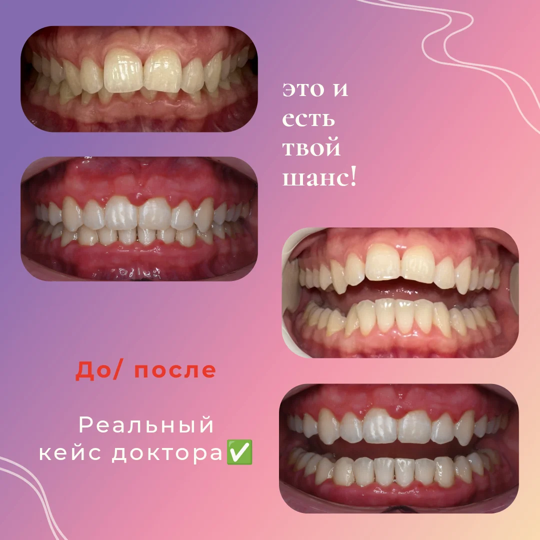 модели для ортодонта - миниатюра 2