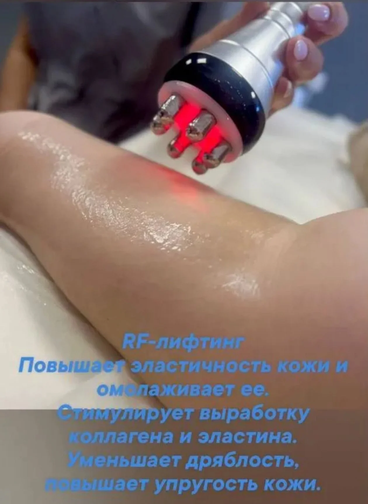 LPG массаж - миниатюра 4