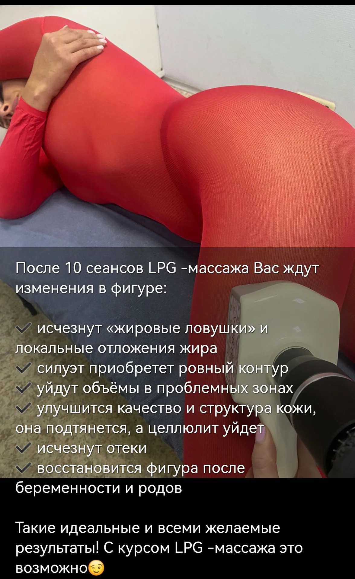 LPG массаж - миниатюра 5
