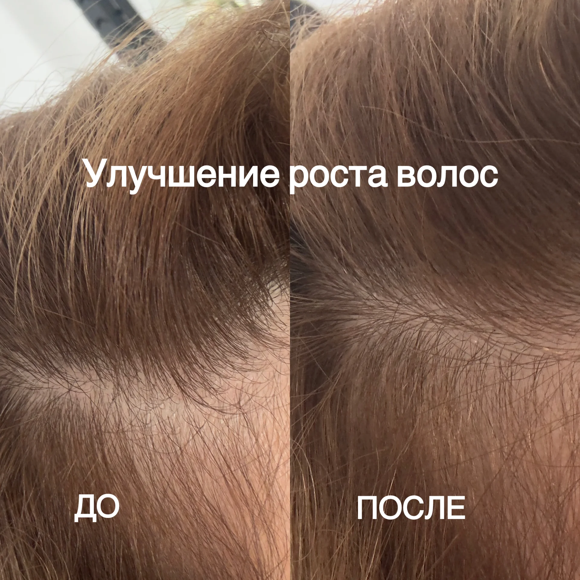 Кератин Ботокс Биозавивка Антизавивка - миниатюра 12