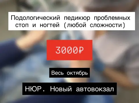 Подолог Вросший Ноготь грибок МозольТрещины