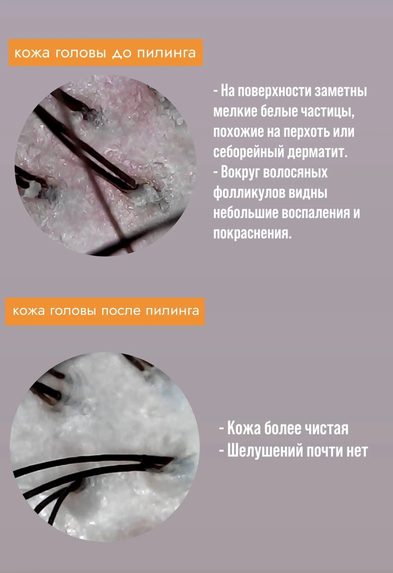 Холодное восстановление волос 6в1 - миниатюра 3
