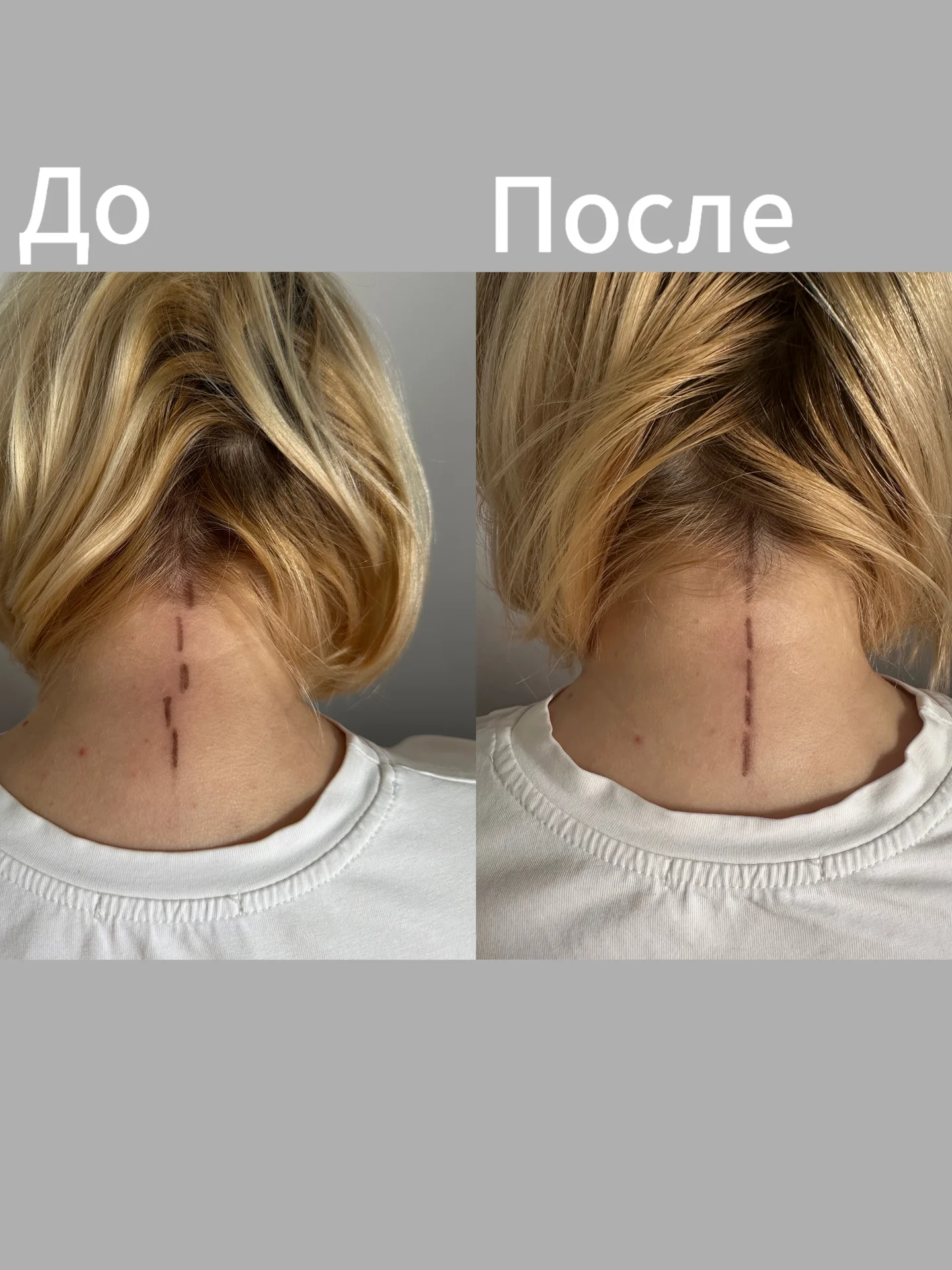 Массаж - миниатюра 6