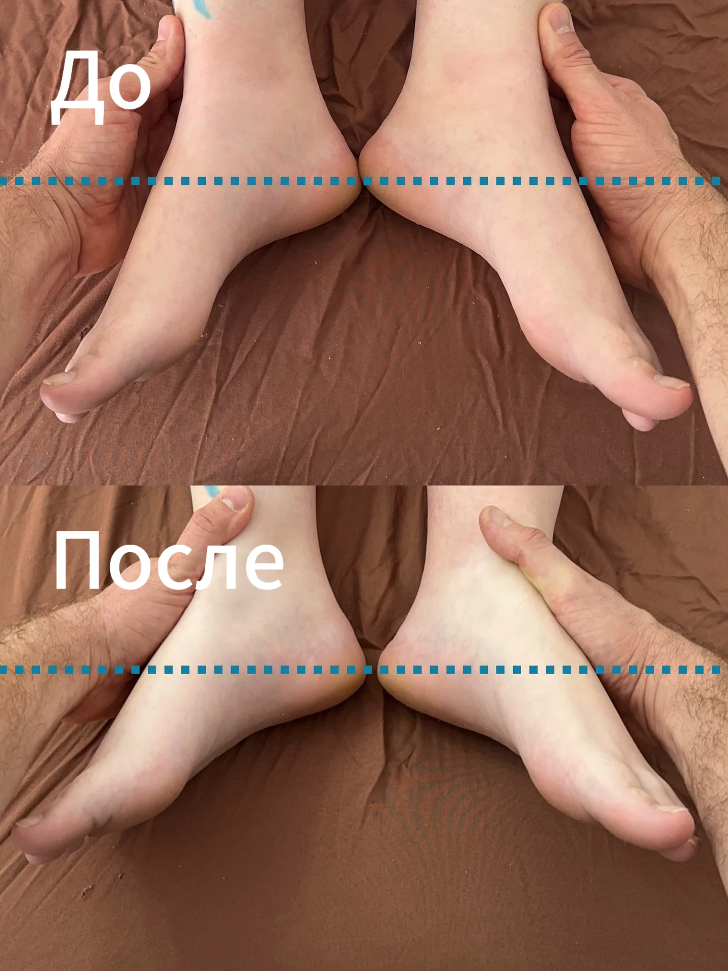 Массаж - миниатюра 7