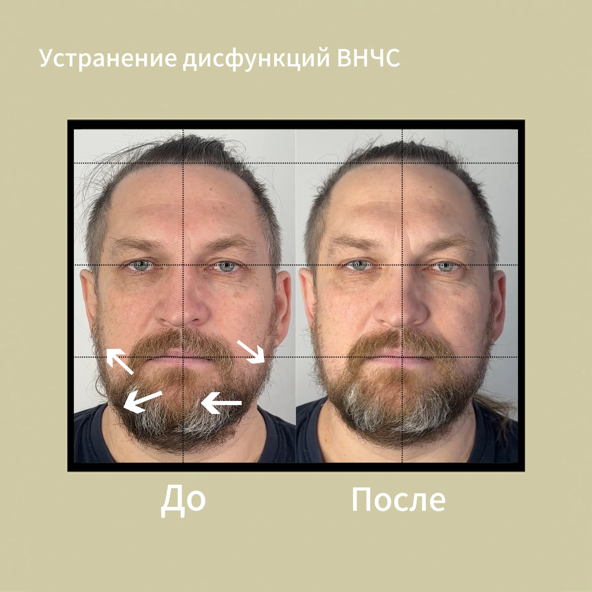 Массаж - миниатюра 9
