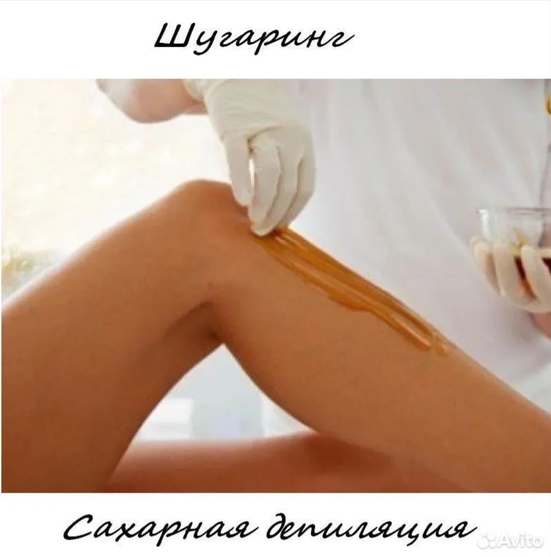 Шугаринг - изображение 1