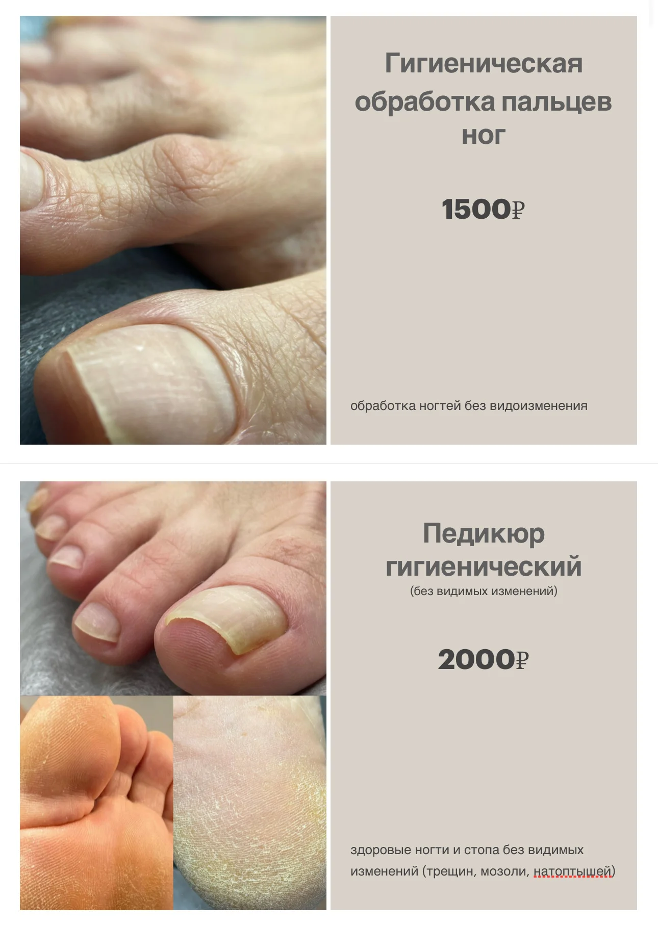 Подолог - миниатюра 2