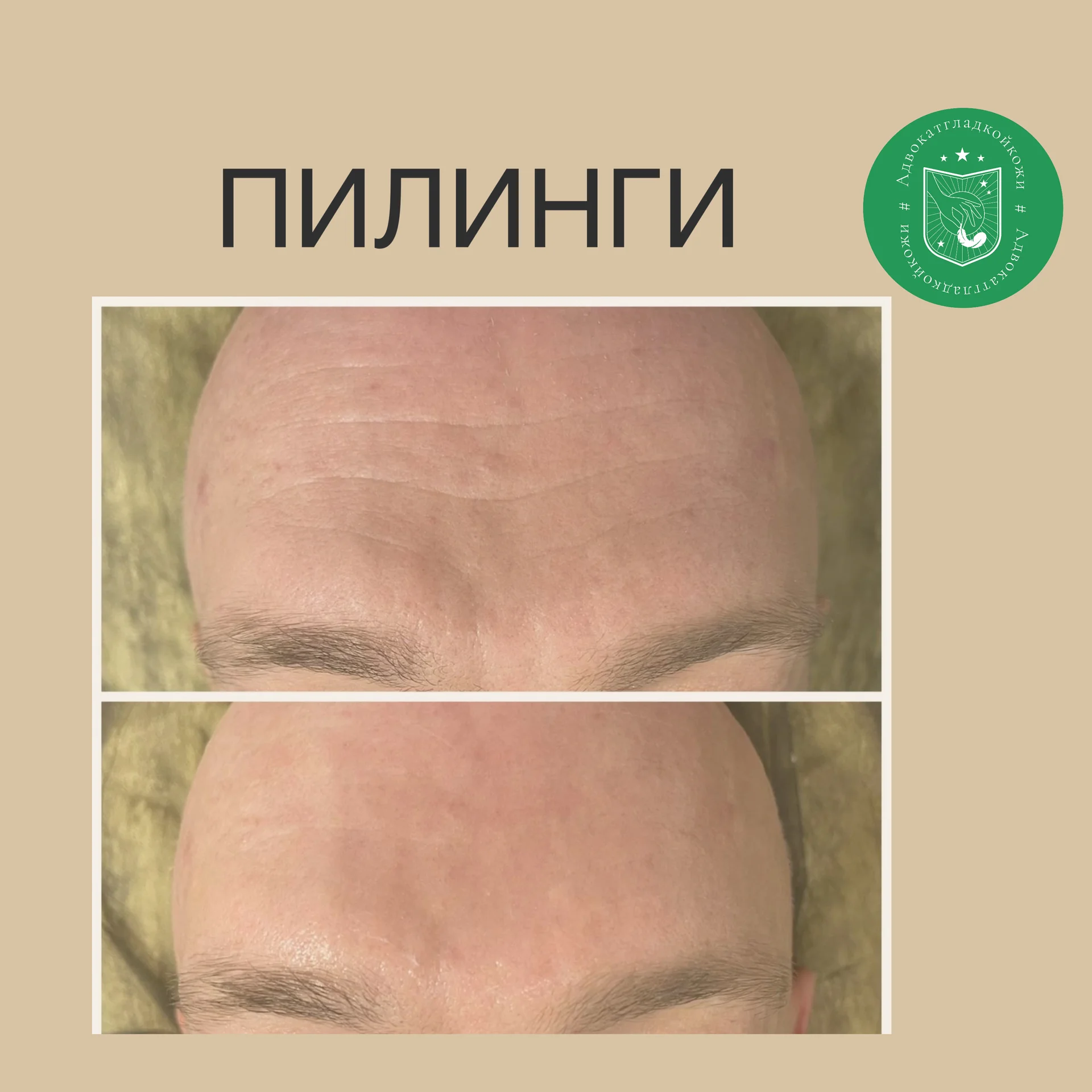 Мужская косметология - миниатюра 10