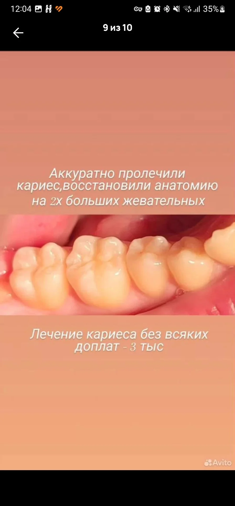 Стоматолог Махачкала - миниатюра 5
