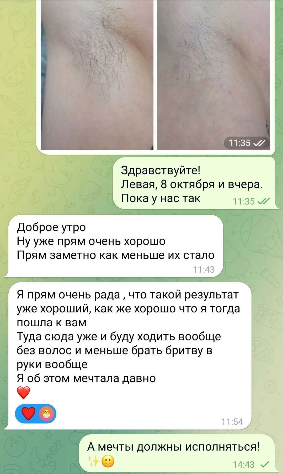 Электроэпиляция любой зоны - миниатюра 12