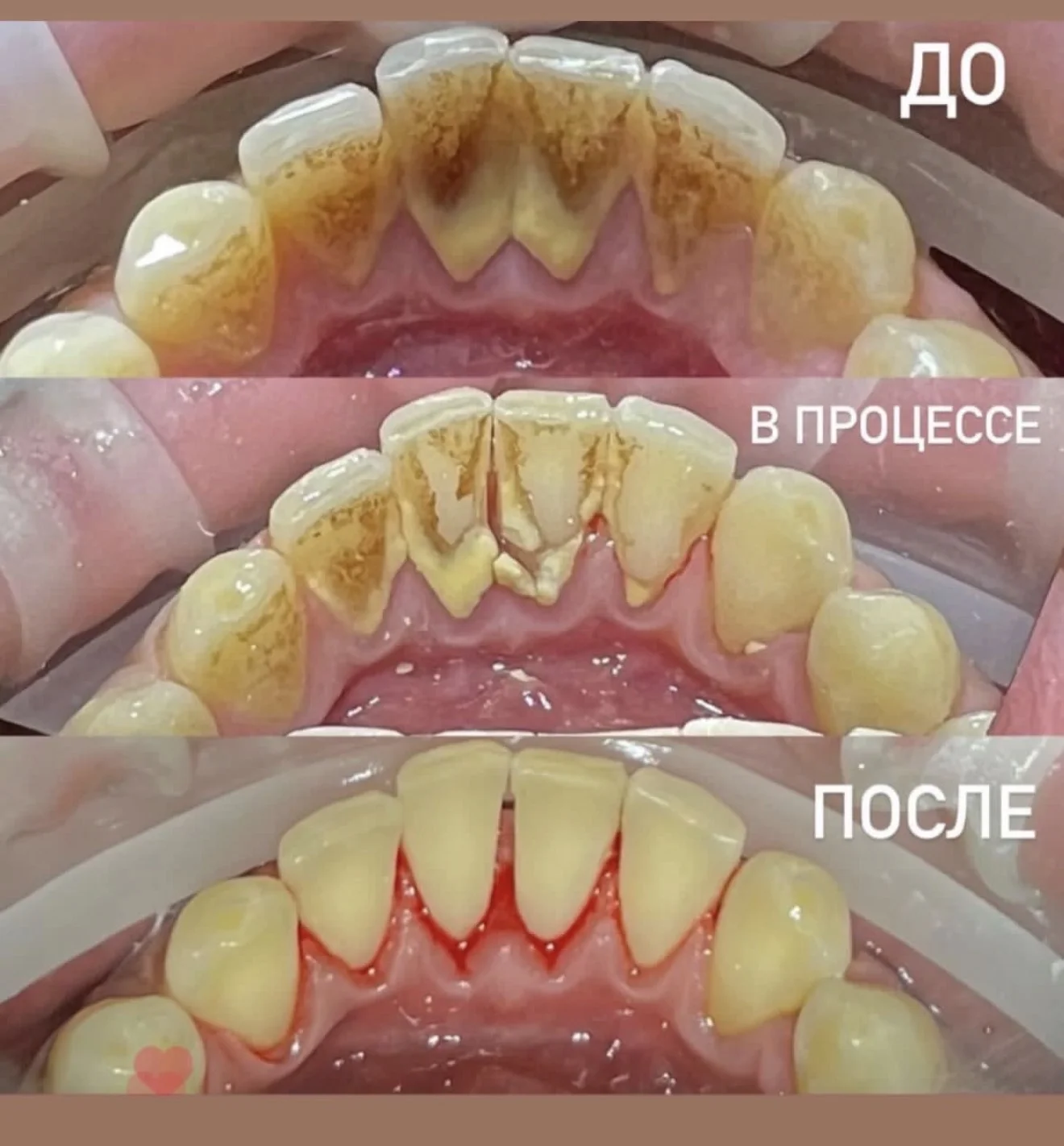 Стоматолог-терапевт - миниатюра 4