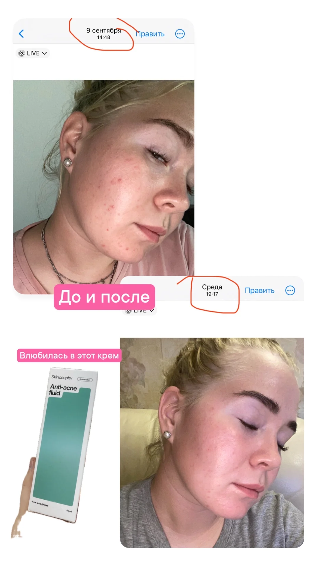 Подбор домашнего ухода - миниатюра 2