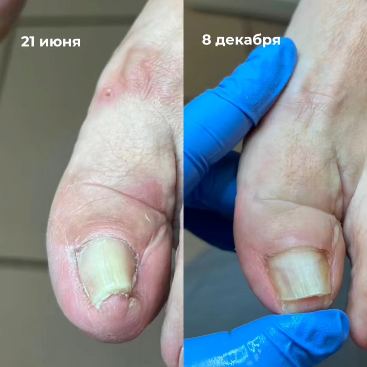 Модель на сложный педикюр - миниатюра 5