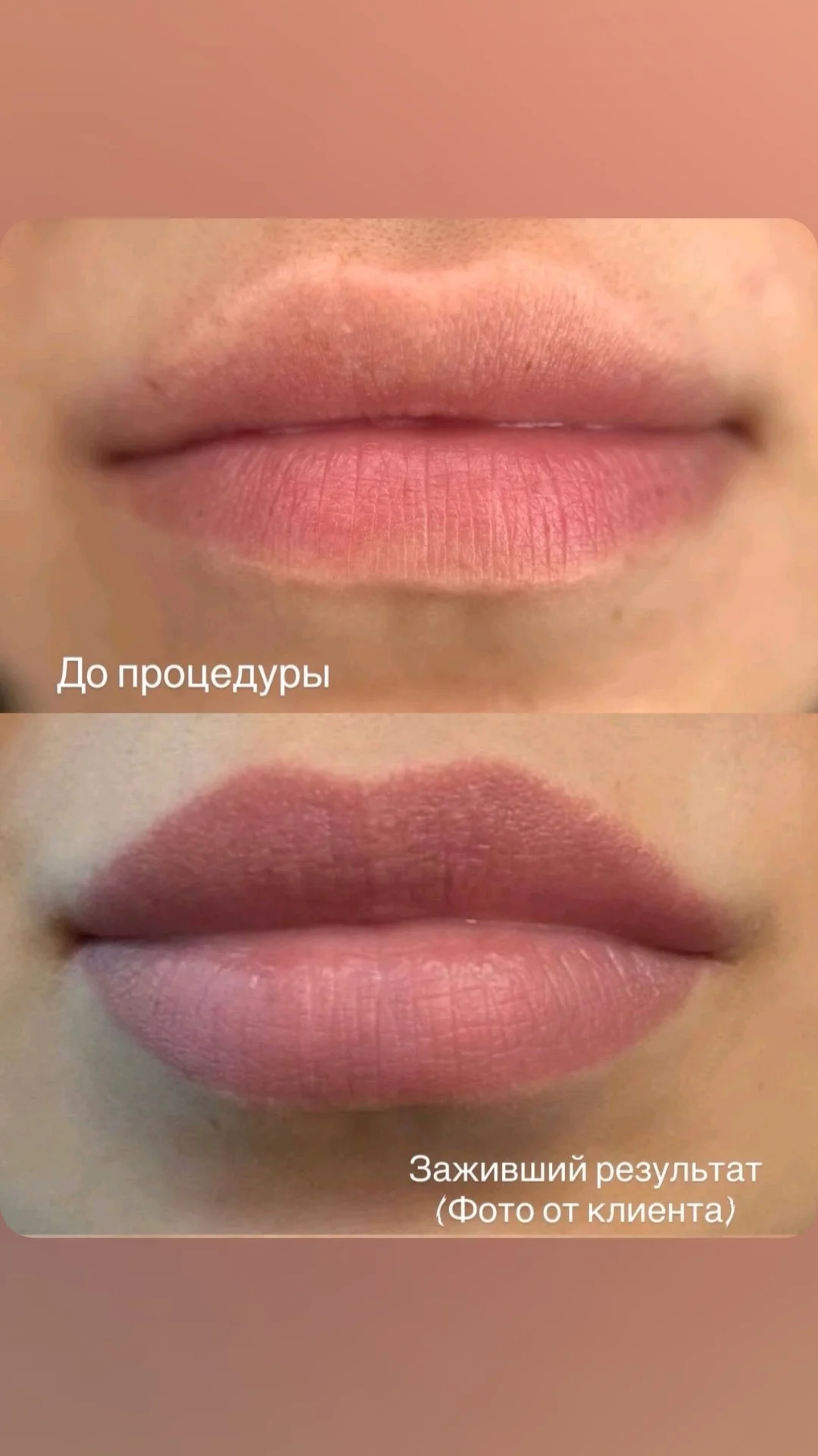 Перманентный макияж, татуаж - миниатюра 5