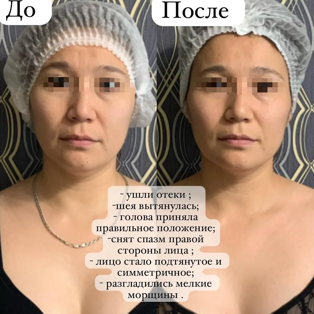 Массаж лица - миниатюра 2