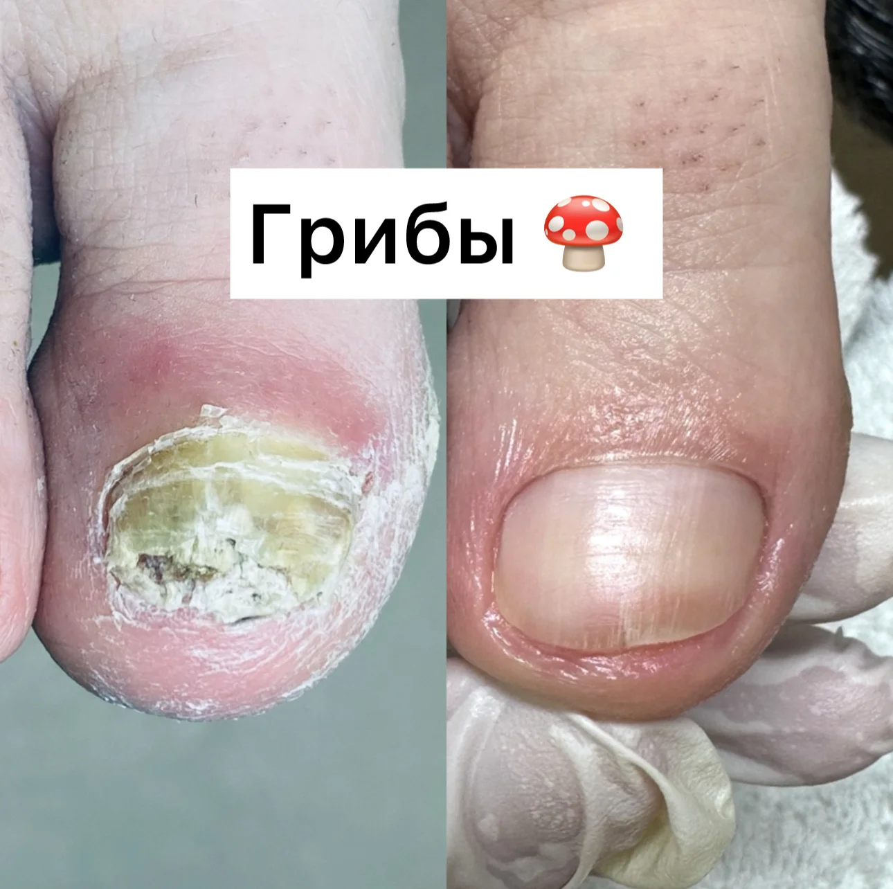 Подолог - миниатюра 16