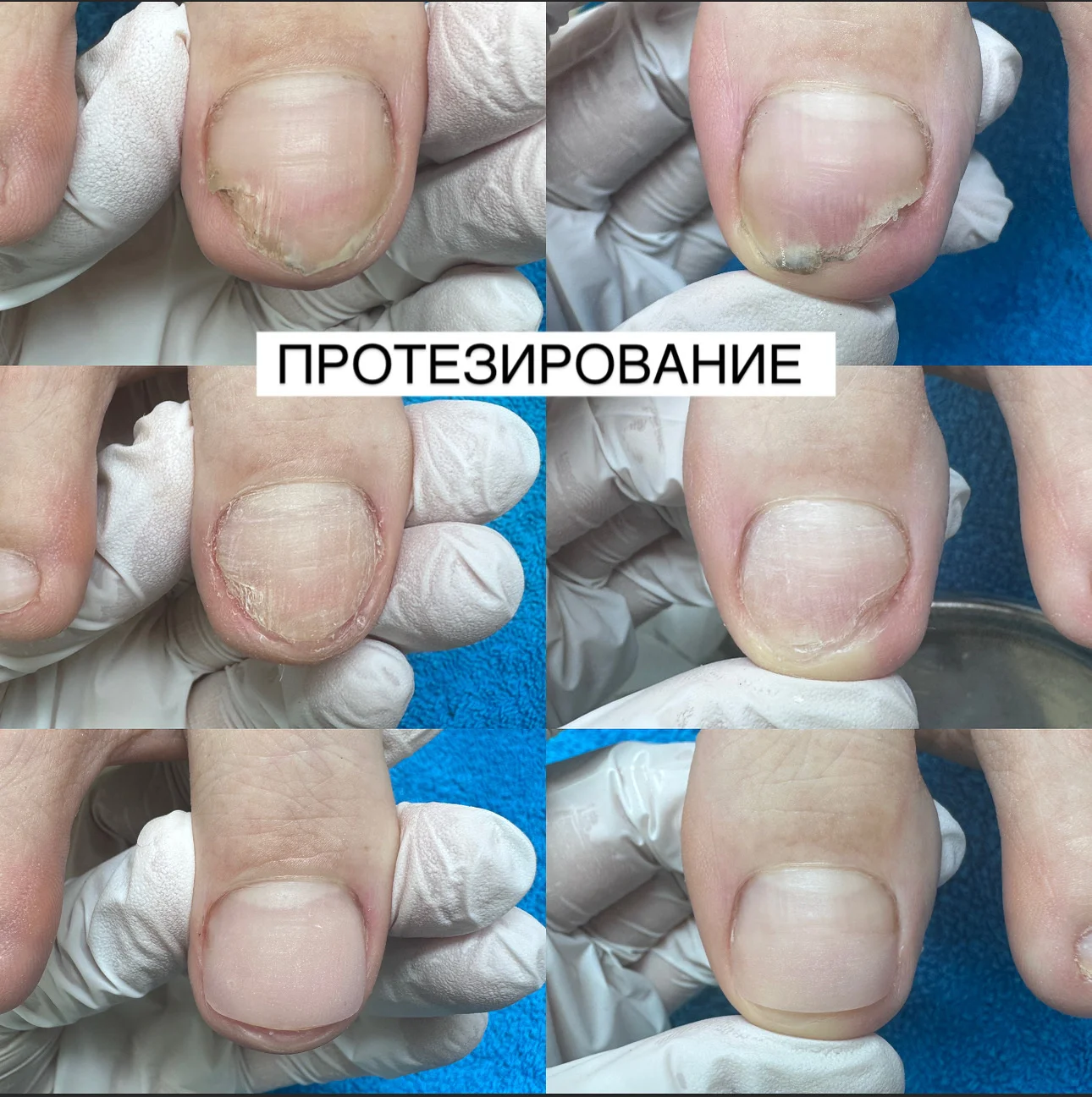 Подолог - миниатюра 30