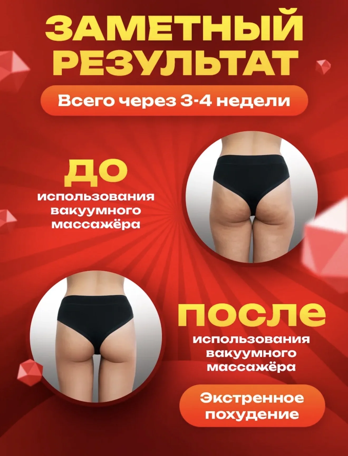 Массажем вакуумный антицеллюлитный - миниатюра 3