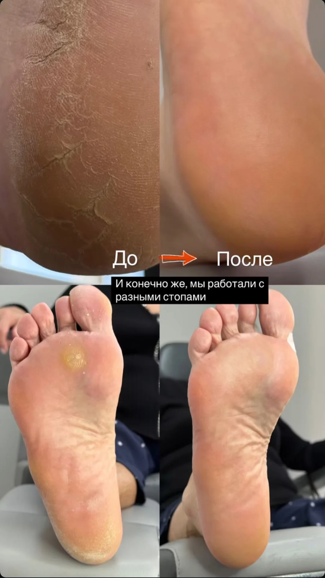Маникюр, педикюр, наращивание - миниатюра 5