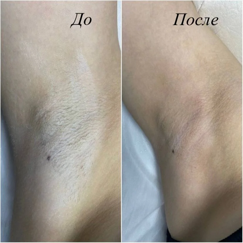 Модели на шугаринг - изображение 1
