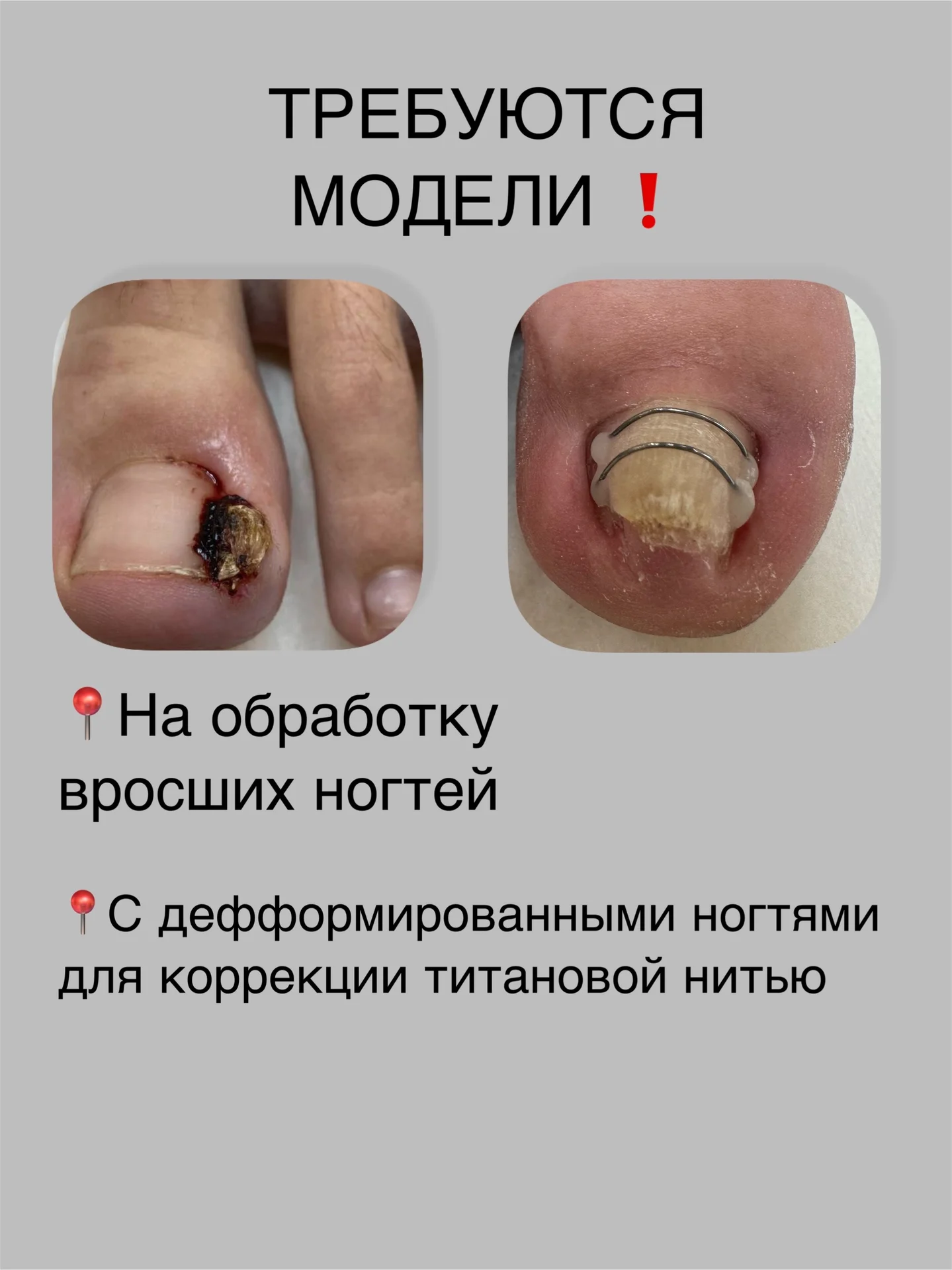МОДЕЛЬ НА ПЕДИКЮР - изображение 1
