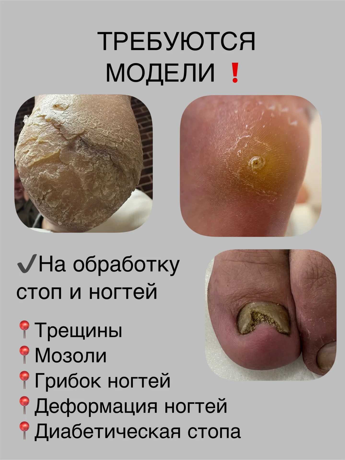 Требуется модель на подологический педикюр - изображение 1