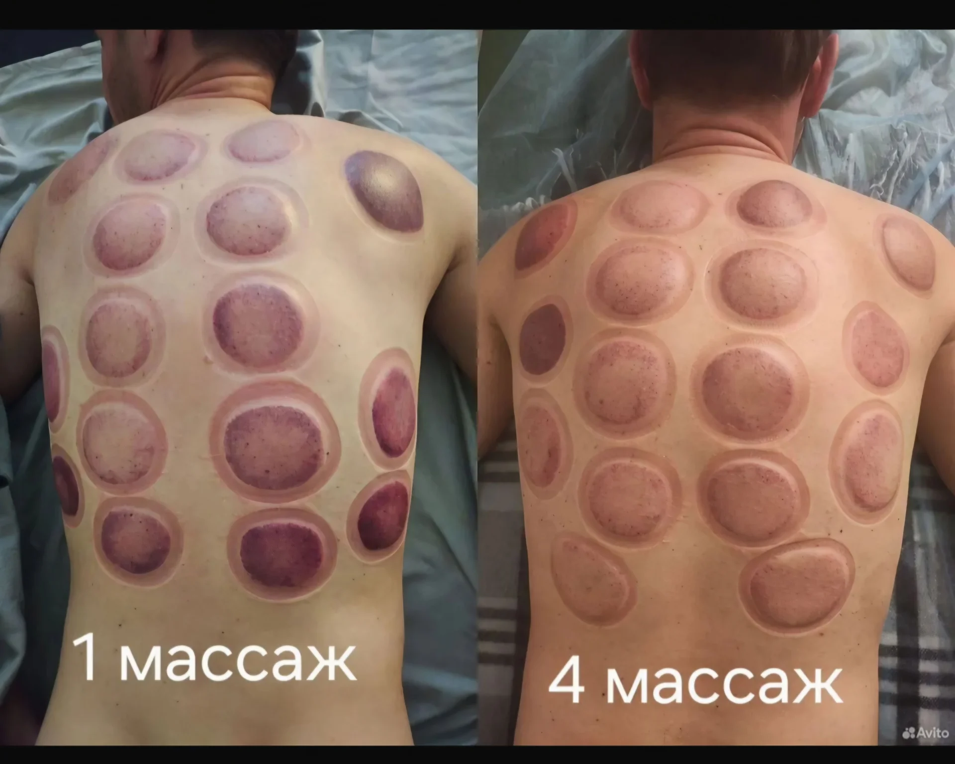 Спортивный массаж, массаж лица, спины, тела - миниатюра 2