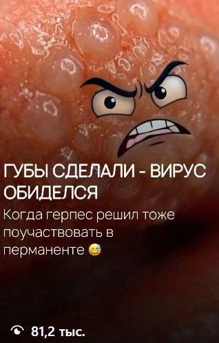 Создание вирусных Reels / увеличение просмотров - изображение 1