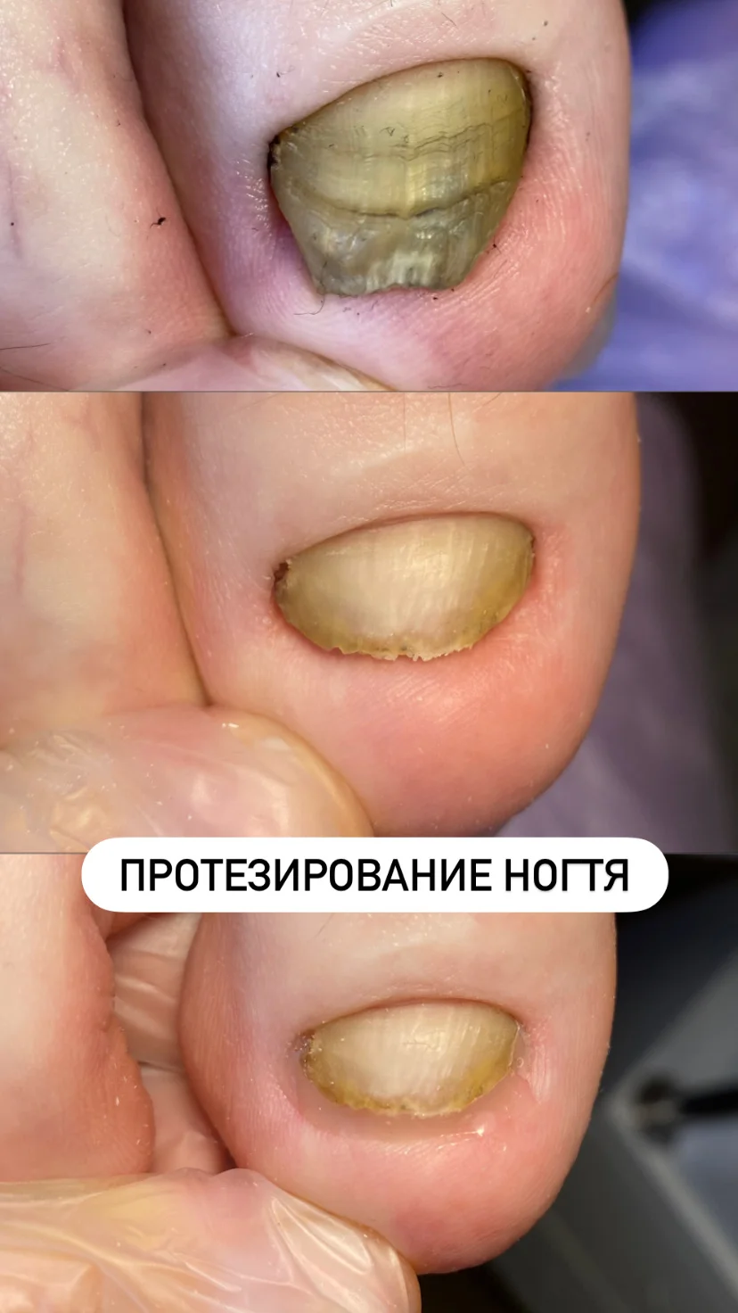 Подолог/медицинский педикюр - миниатюра 4