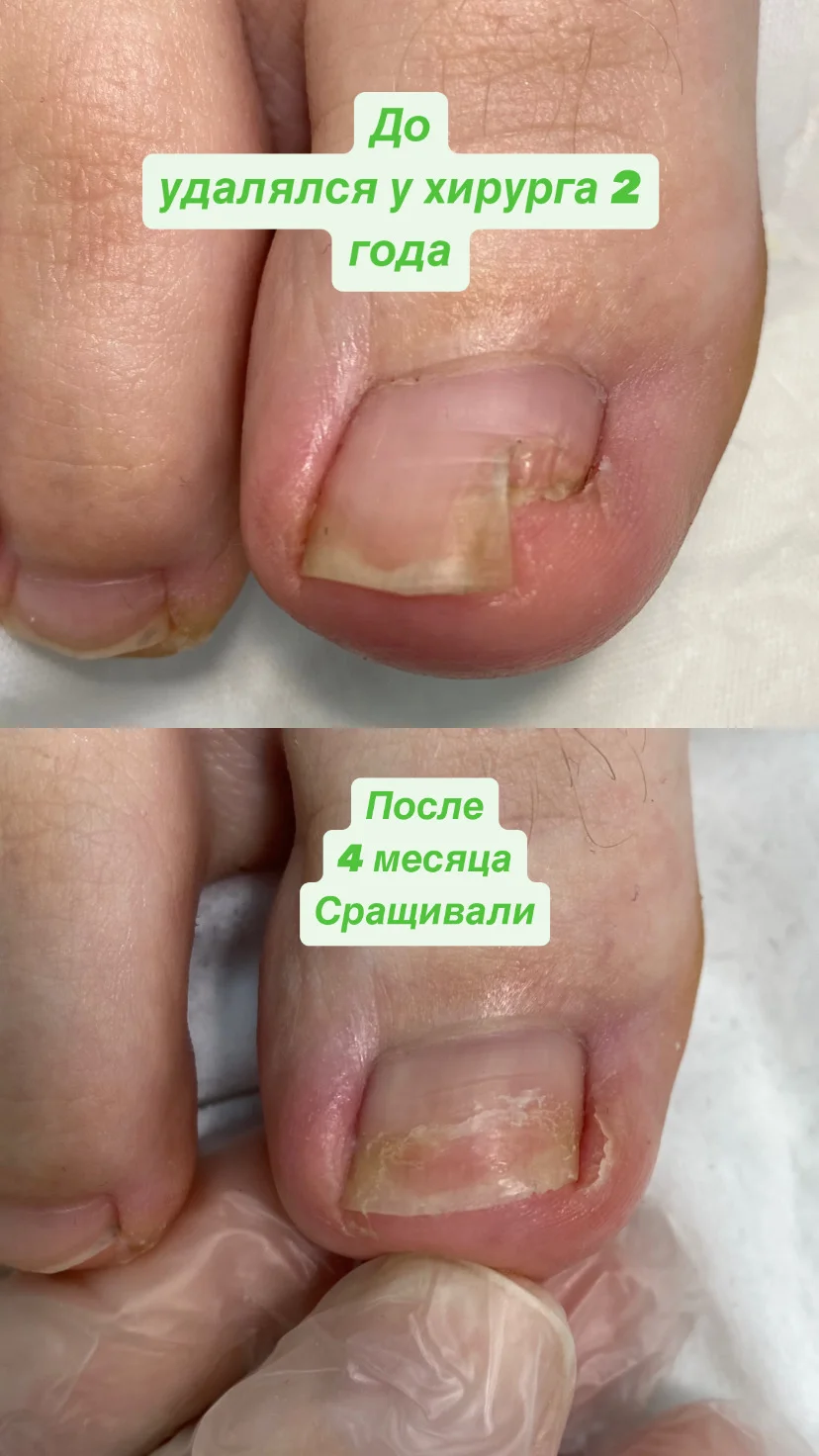 Подолог/медицинский педикюр - миниатюра 7