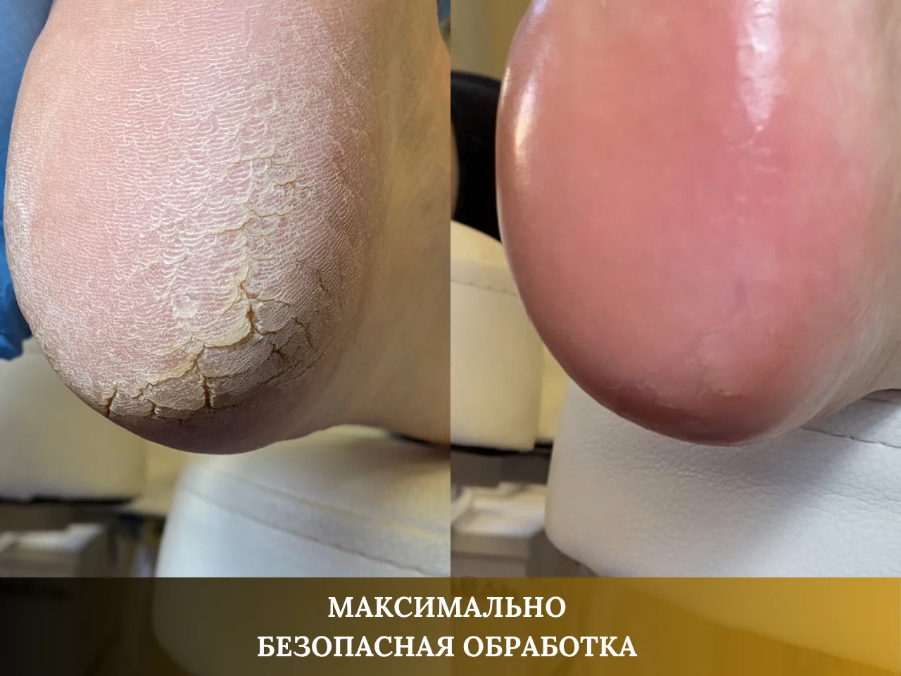 МАНИКЮР / ПЕДИКЮР - миниатюра 7