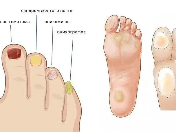 Подолог - миниатюра 5