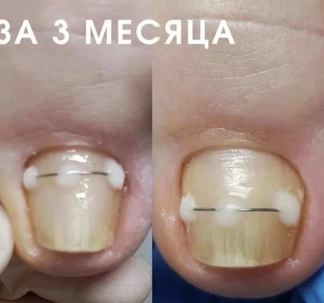 Маникюр - миниатюра 9