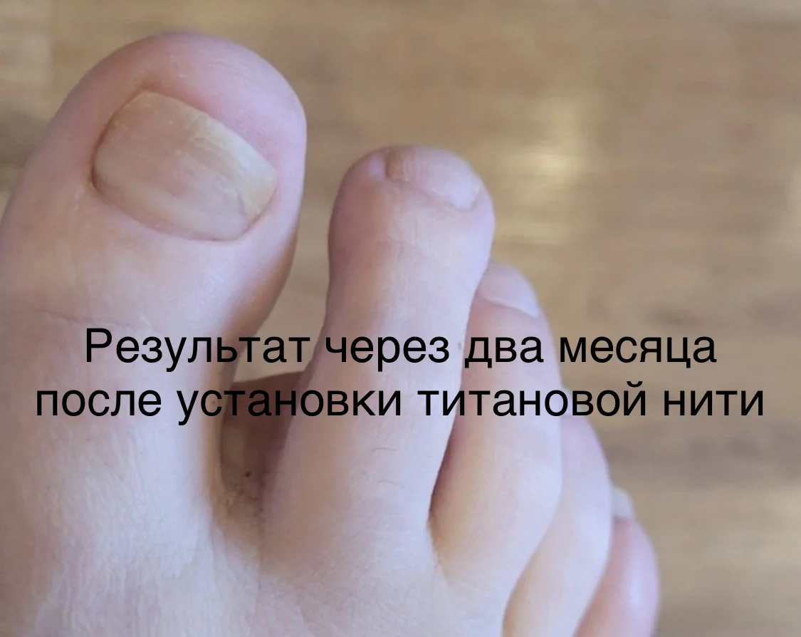 Подолог педикюр - миниатюра 10
