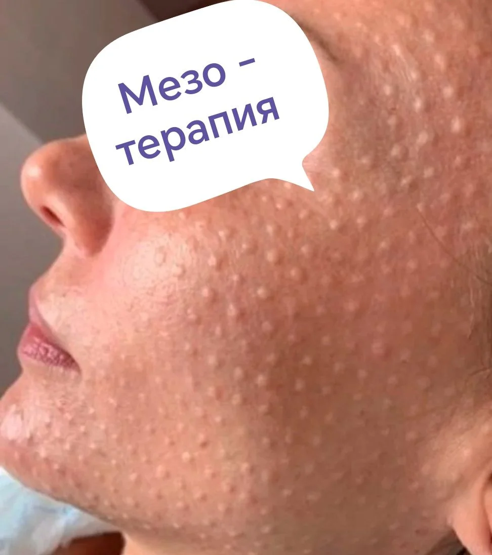 Косметология - миниатюра 2
