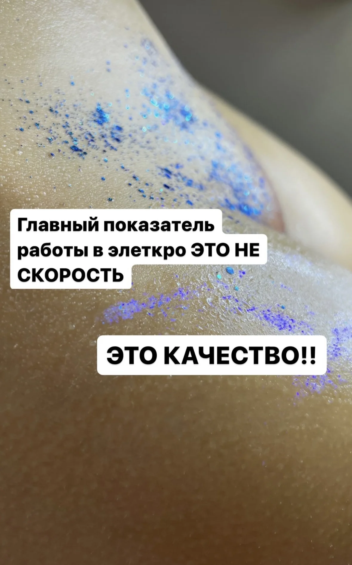 Электроэпиляция - миниатюра 4