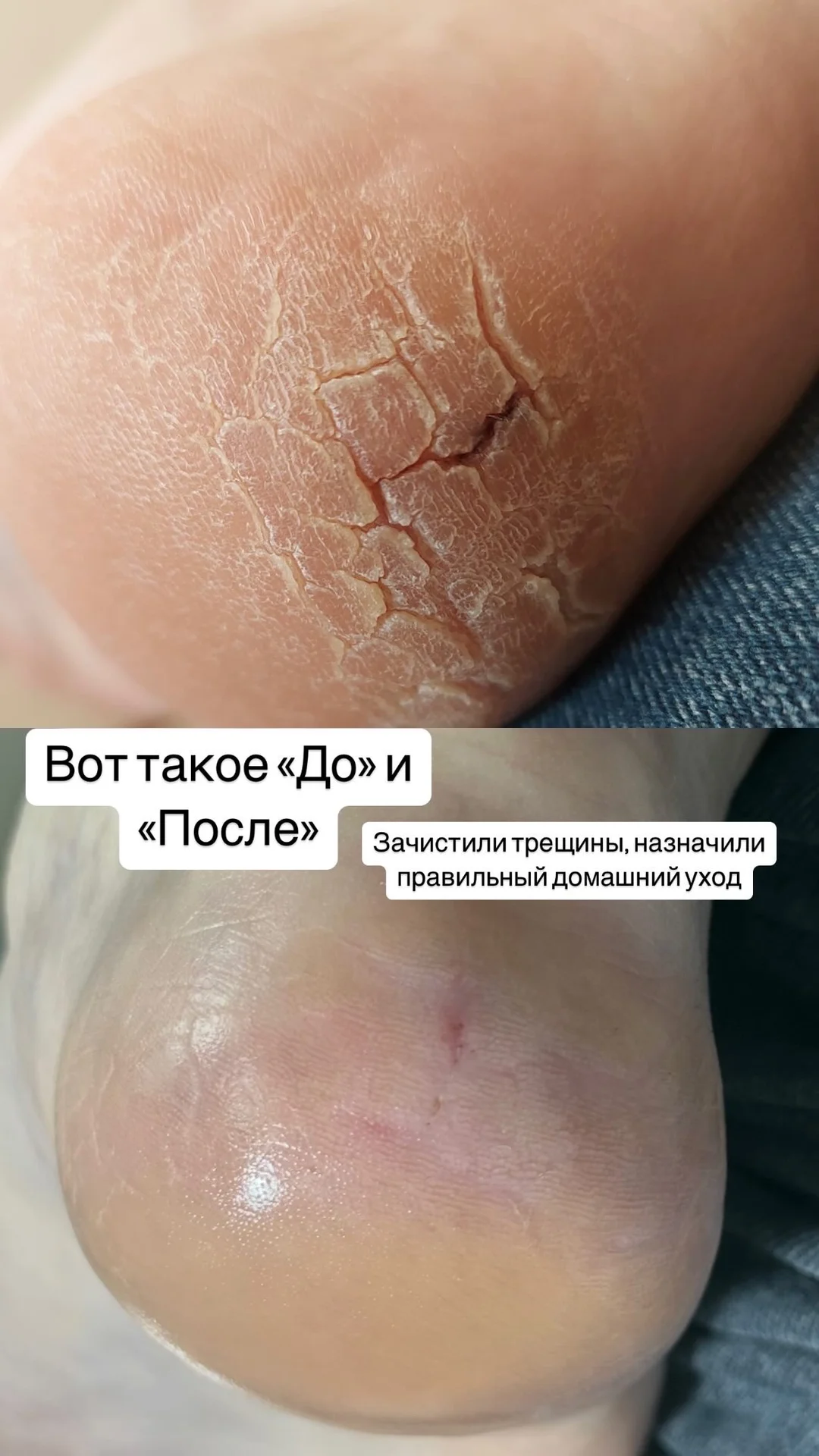 Маникюр, педикюр, подология, коррекция - миниатюра 10