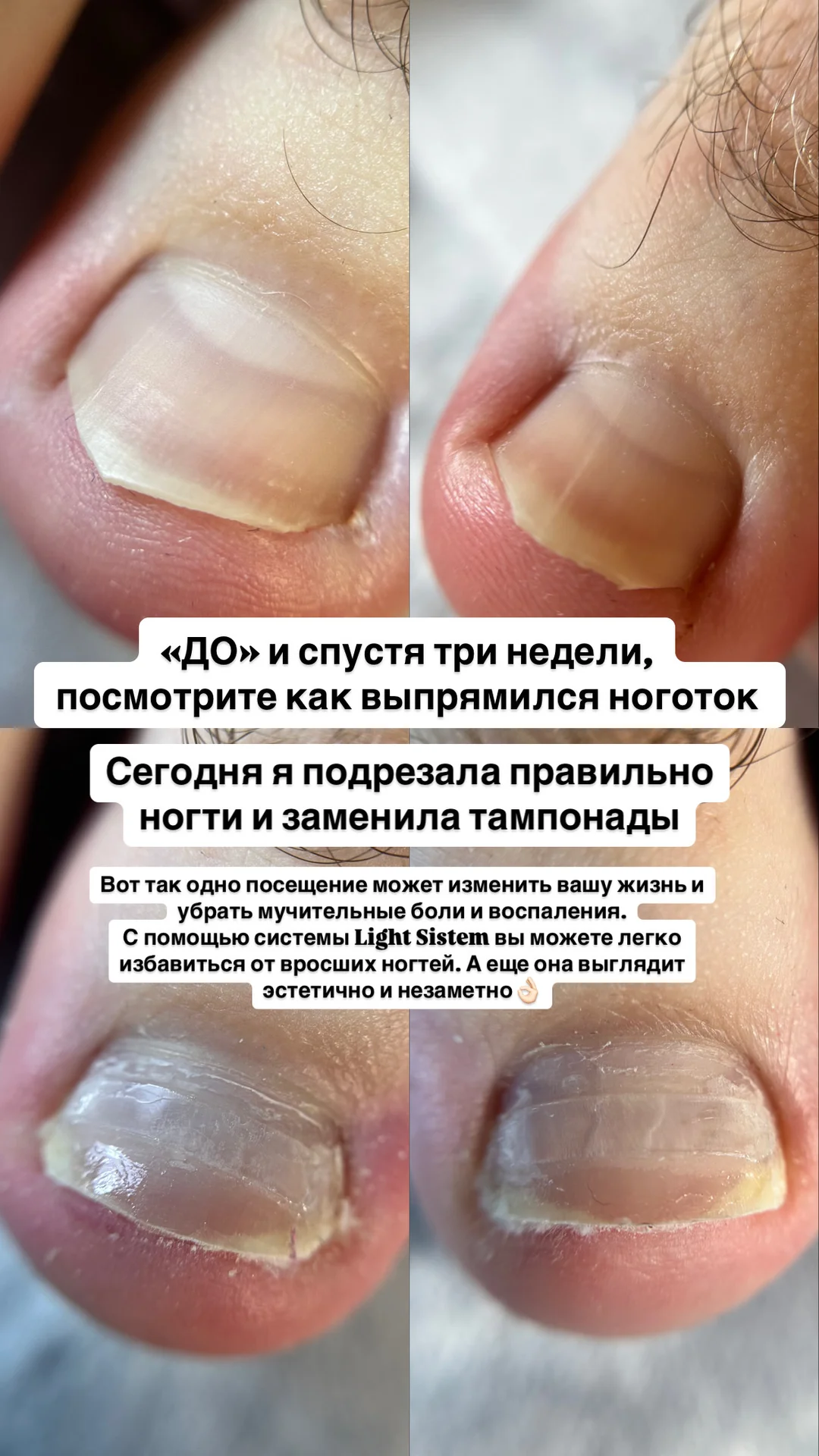 Маникюр, педикюр, подология, коррекция - миниатюра 15