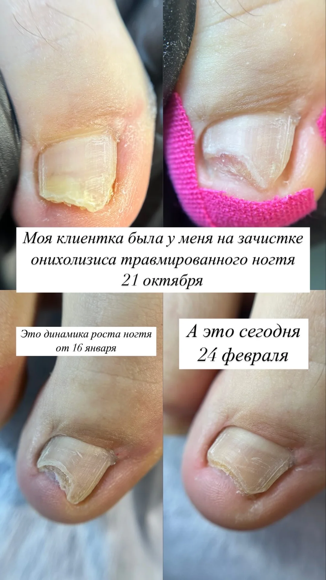 Маникюр, педикюр, подология, коррекция - миниатюра 18