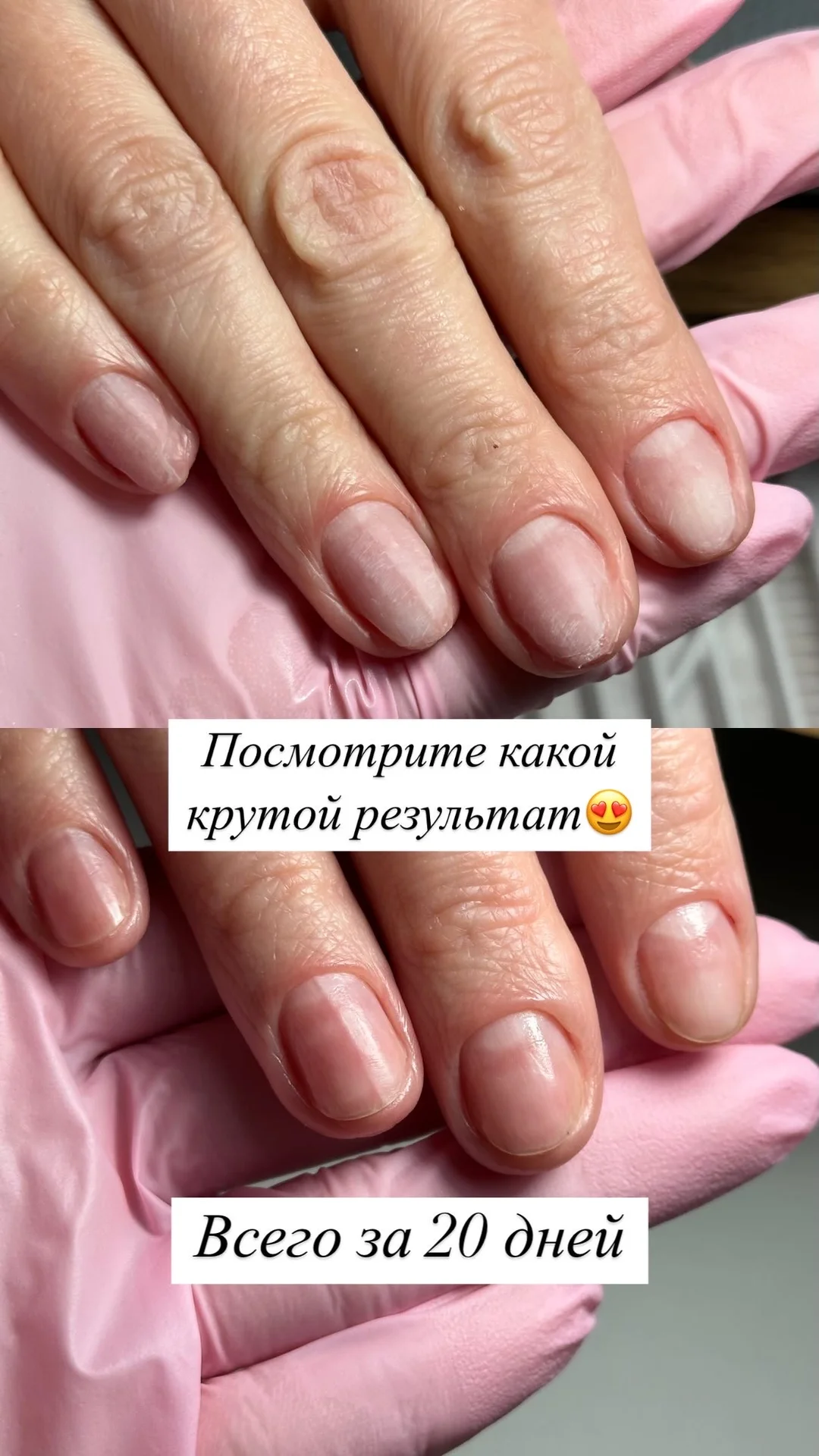 Маникюр, педикюр, подология, коррекция - миниатюра 23