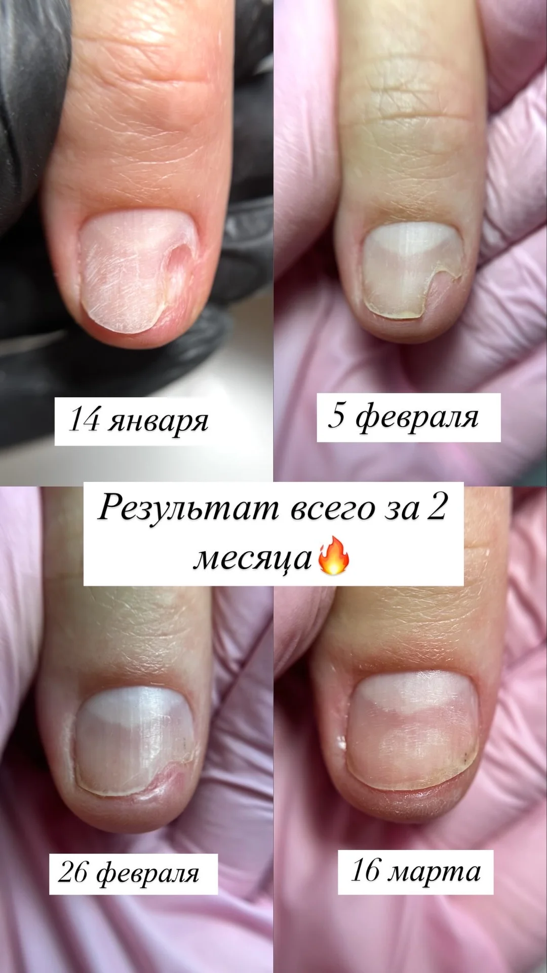 Маникюр, педикюр, подология, коррекция - миниатюра 24