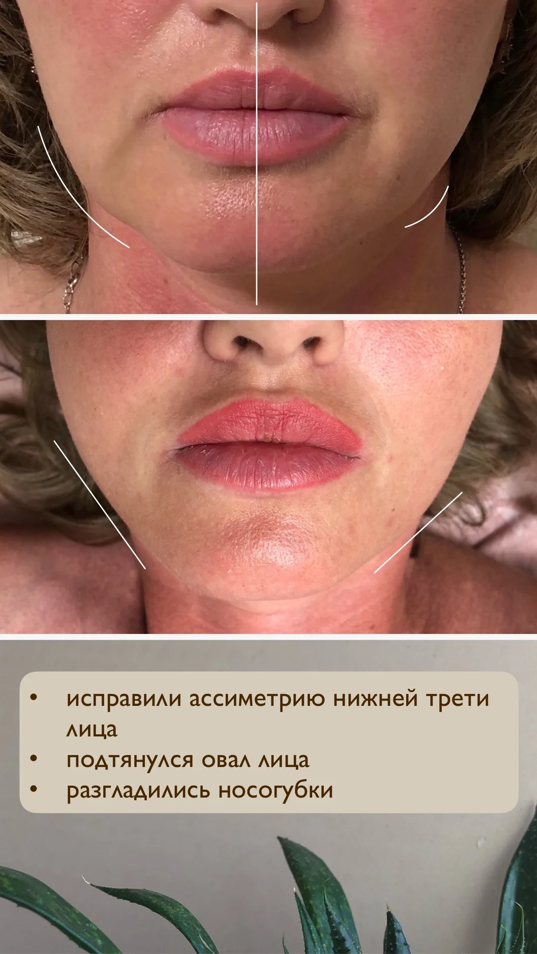 Массаж лица - миниатюра 2