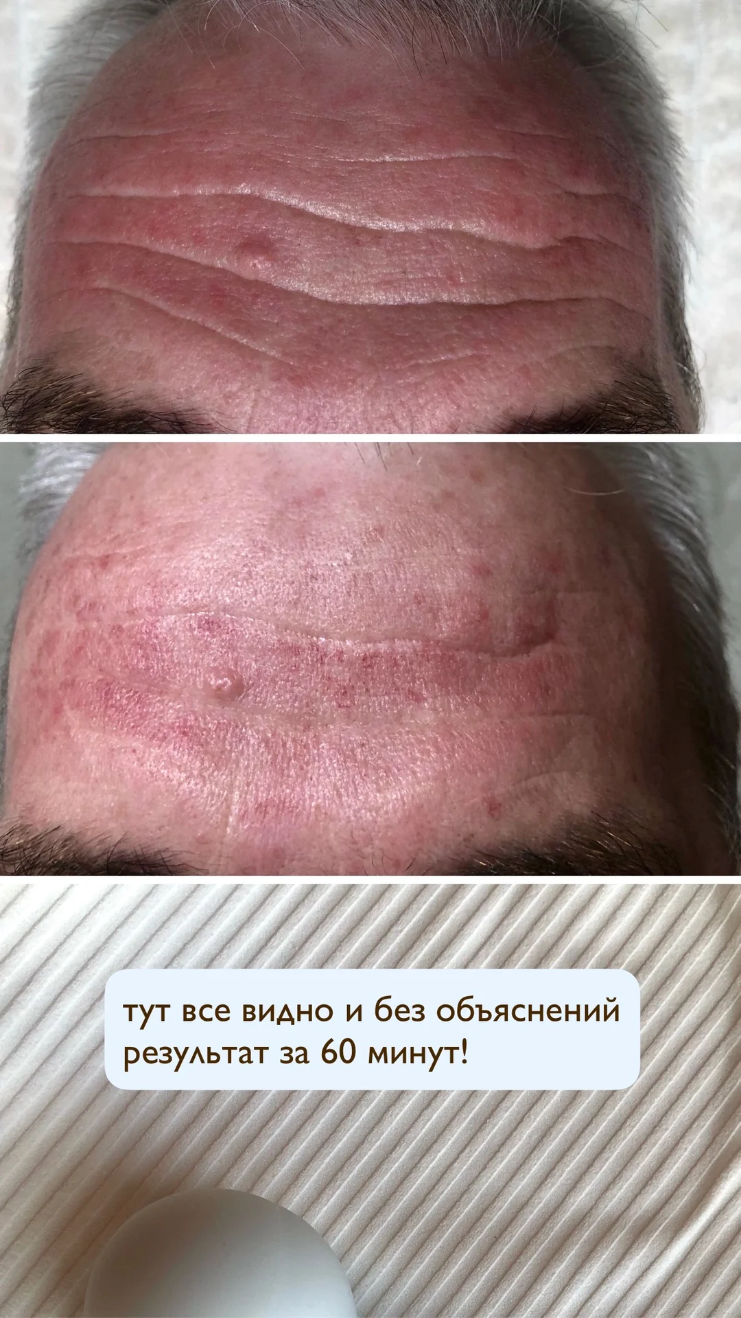 Массаж лица - миниатюра 3