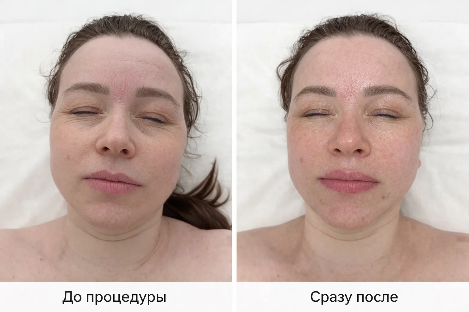 Массаж лица - миниатюра 4