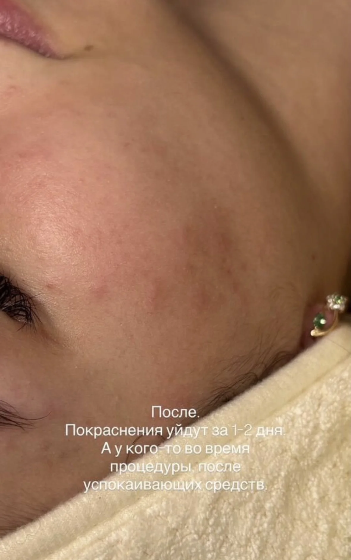 Массаж лица, чистка лица - миниатюра 7