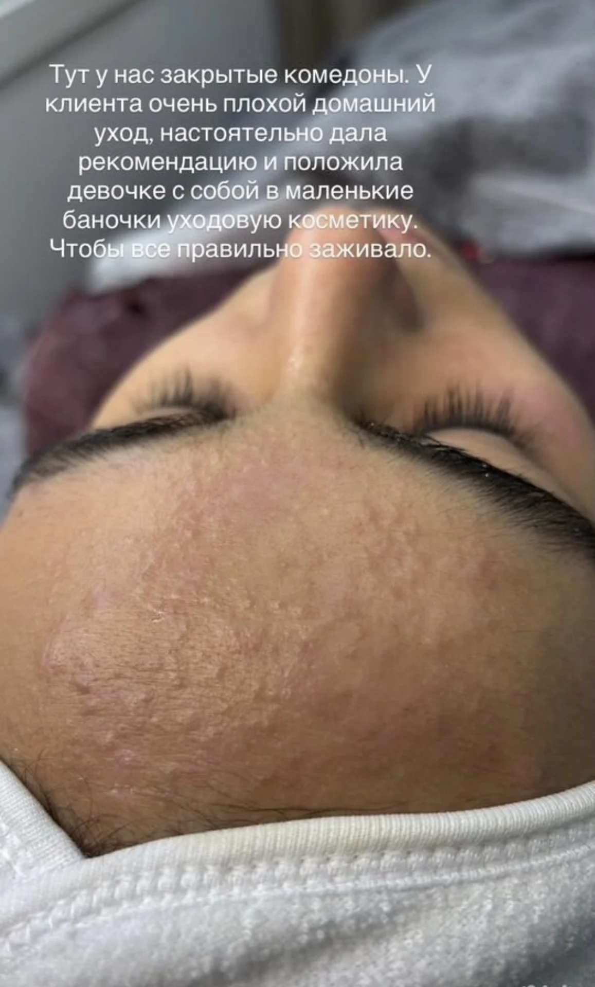 Массаж лица, чистка лица - миниатюра 8