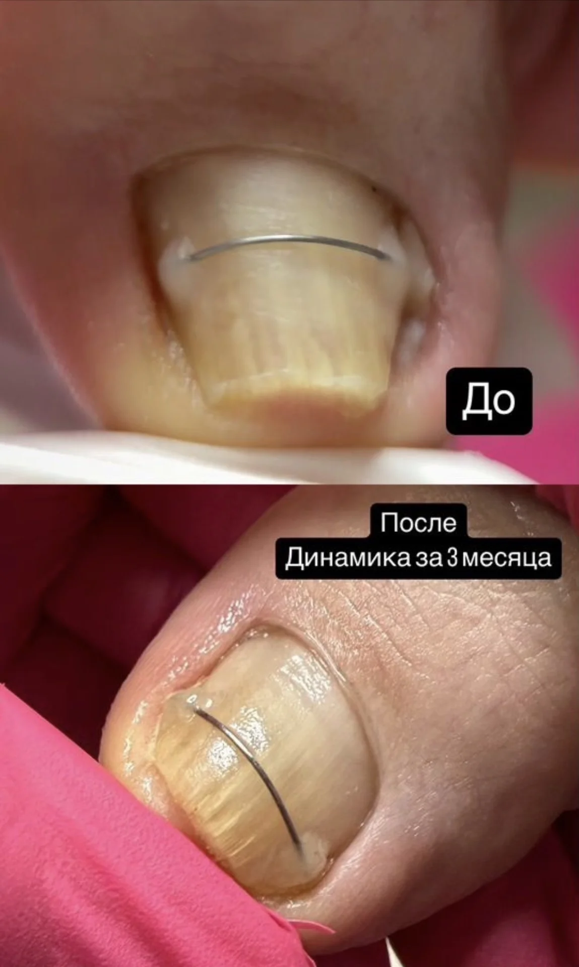 Подолог - миниатюра 6