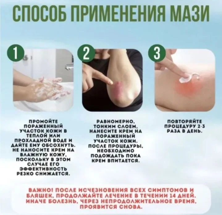 Мазь от псориаза - миниатюра 2