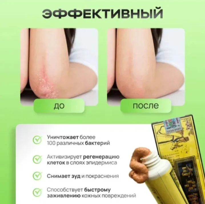 Мазь от псориаза - миниатюра 3